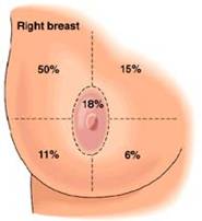 Brustkrebshäufigkeit por Quadrant